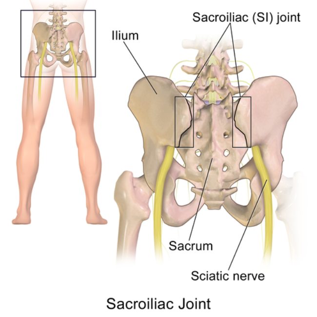 sacroiliac joint injection technique